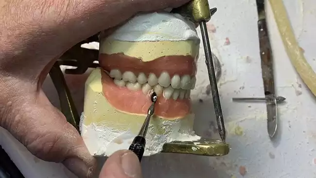 Adjusting Teeth In Wax Denture Center Missoula Mt