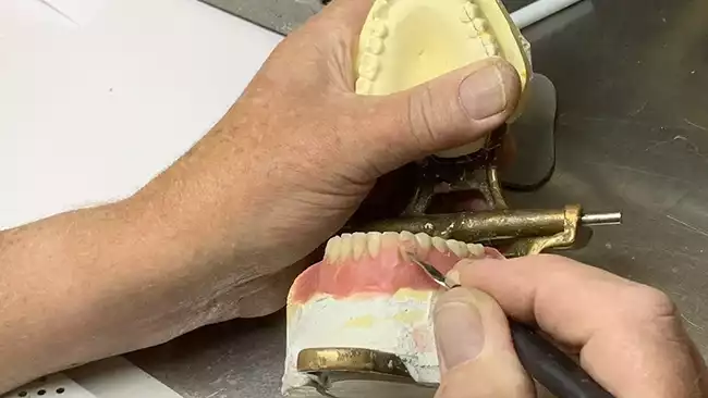 Carving Gum Detail Around Teeth Denture Center Missoula Mt