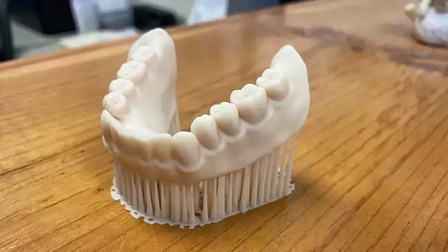 Printed Lower Before We Remove The Supports Denture Center Missoula Mt